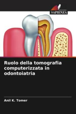 Ruolo della tomografia computerizzata in odontoiatria