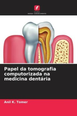 Papel da tomografia computorizada na medicina dentária