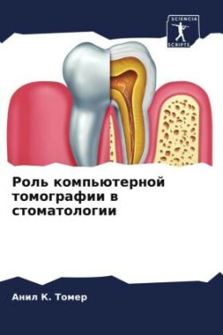 Роль компьютерной томографии в стоматоло