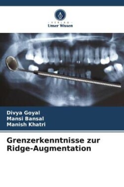 Grenzerkenntnisse zur Ridge-Augmentation