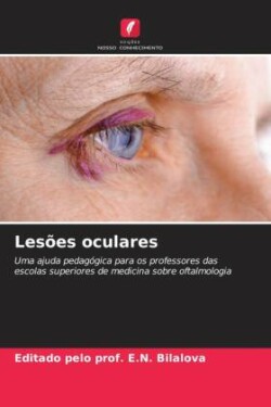 Lesões oculares