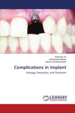 Complications in Implant