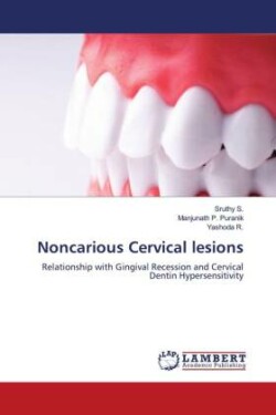 Noncarious Cervical lesions