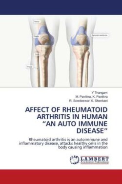 Affect of Rheumatoid Arthritis in Human "An Auto Immune Disease"