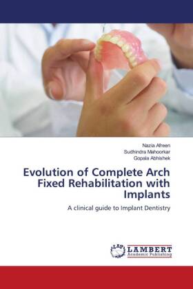 Evolution of Complete Arch Fixed Rehabilitation with Implants