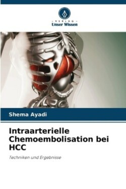 Intraarterielle Chemoembolisation bei HCC