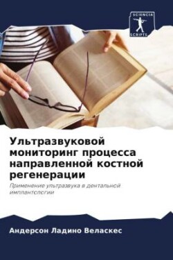 Ультразвуковой мониторинг процесса напр&