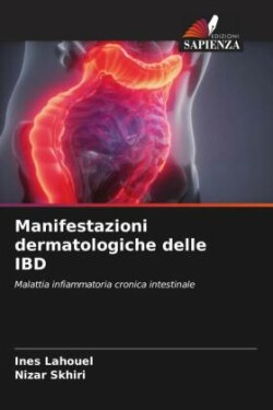 Manifestazioni dermatologiche delle IBD