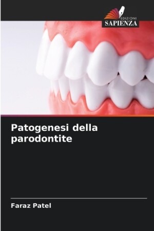 Patogenesi della parodontite