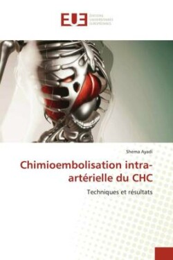 Chimioembolisation intra-artérielle du CHC