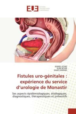 Fistules uro-génitales : expérience du service d'urologie de Monastir