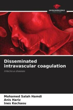 Disseminated intravascular coagulation