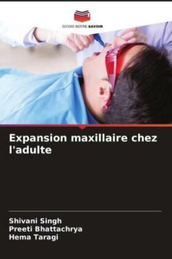 Expansion maxillaire chez l'adulte