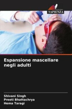 Espansione mascellare negli adulti