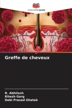 Greffe de cheveux