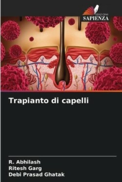 Trapianto di capelli