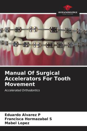 Manual Of Surgical Accelerators For Tooth Movement