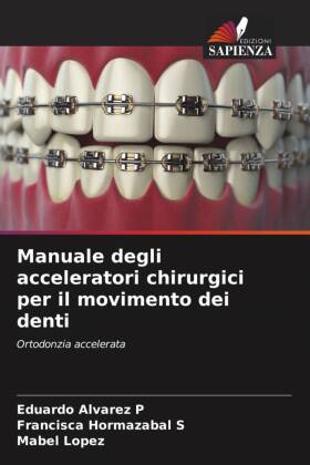 Manuale degli acceleratori chirurgici per il movimento dei denti