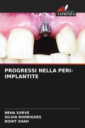 PROGRESSI NELLA PERI-IMPLANTITE