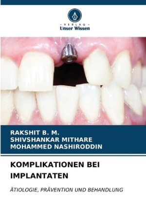 Komplikationen Bei Implantaten