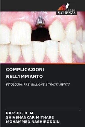 Complicazioni Nell'impianto