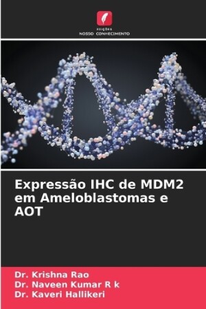 Expressão IHC de MDM2 em Ameloblastomas e AOT
