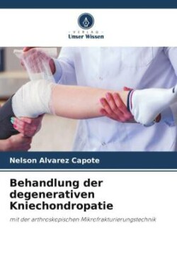 Behandlung der degenerativen Kniechondropatie