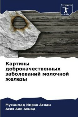 Картины доброкачественных заболеваний м&