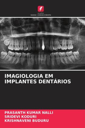 Imagiologia Em Implantes Dent�rios
