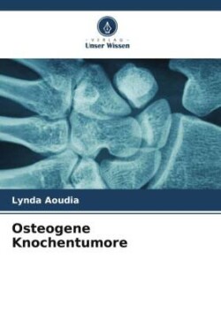 Osteogene Knochentumore