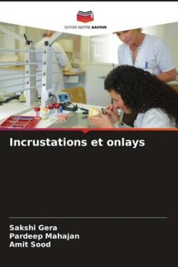 Incrustations et onlays