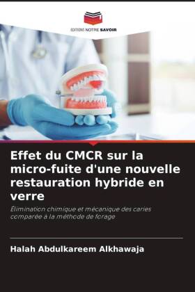 Effet du CMCR sur la micro-fuite d'une nouvelle restauration hybride en verre