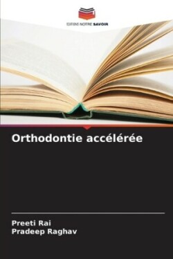 Orthodontie accélérée