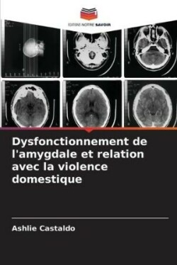 Dysfonctionnement de l'amygdale et relation avec la violence domestique