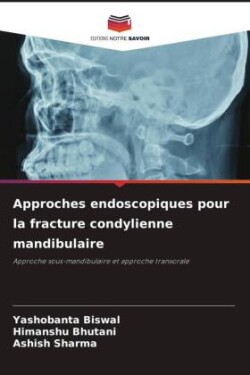 Approches endoscopiques pour la fracture condylienne mandibulaire