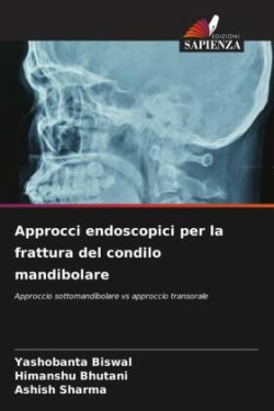 Approcci endoscopici per la frattura del condilo mandibolare