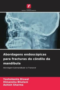 Abordagens endosc�picas para fracturas do c�ndilo da mand�bula