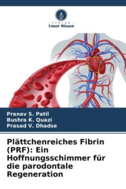 Pl�ttchenreiches Fibrin (PRF)