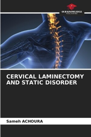 Cervical Laminectomy and Static Disorder