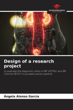 Design of a research project