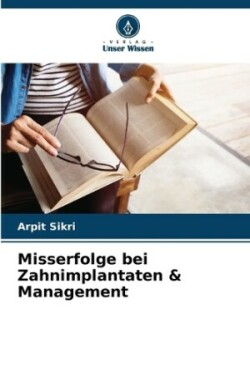 Misserfolge bei Zahnimplantaten & Management