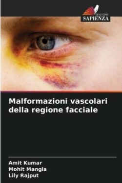 Malformazioni vascolari della regione facciale