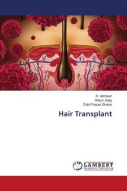 Hair Transplant