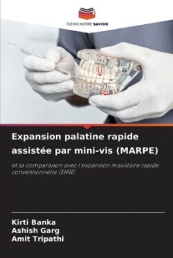 Expansion palatine rapide assist�e par mini-vis (MARPE)