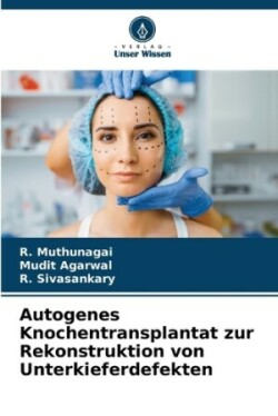 Autogenes Knochentransplantat zur Rekonstruktion von Unterkieferdefekten