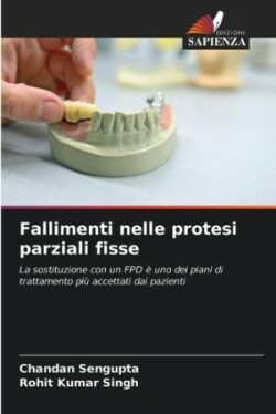 Fallimenti nelle protesi parziali fisse