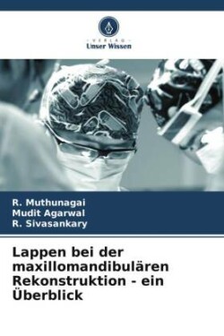 Lappen bei der maxillomandibulären Rekonstruktion - ein Überblick