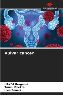 Vulvar cancer