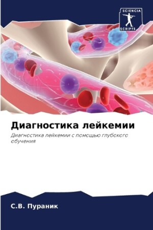 Диагностика лейкемии