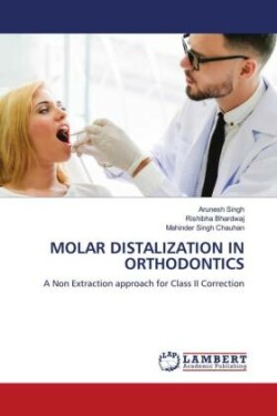 Molar Distalization in Orthodontics